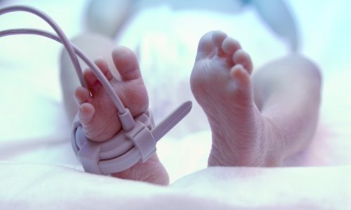 Reducing the risk of cerebral palsy in preterm babies